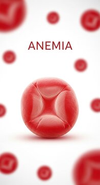 Iron deficiency anemia concept, a critical systemic hematological condition, microscopic abnormal erythrocytes, affecting cellular pathology, medical science research