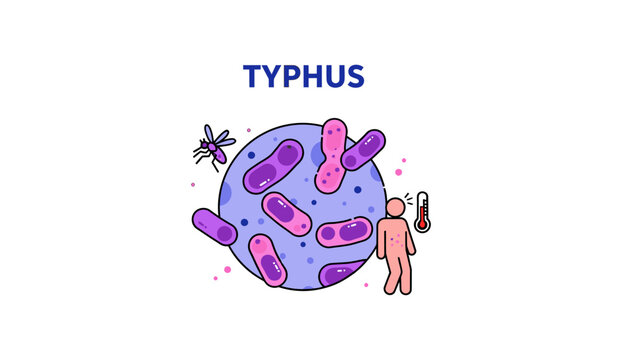 Typhus disease medical infographic vector, rickettsia bacteria with insect vector illustration, infectious high fever healthcare icon.