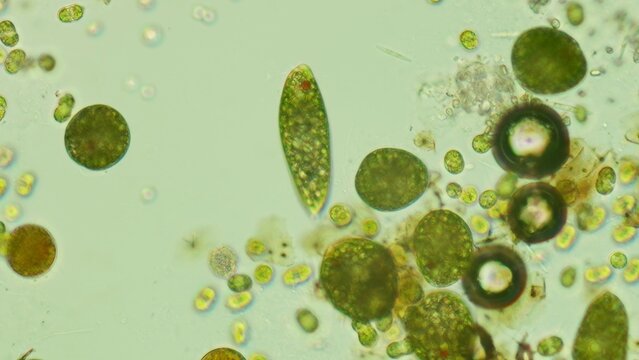 20x Euglena sp. with palmelloid cells under brightfield microscopy