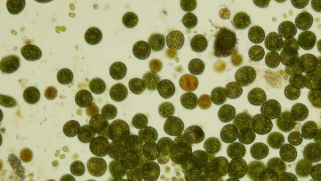 10x Euglena sp. palmelloid stage under brightfield microscopy