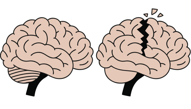 Healthy and damaged human brain side view vector set.