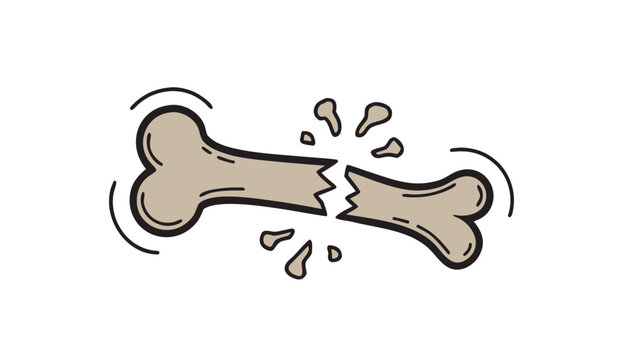 Broken bone cartoon vector illustration depicting fractured femur or humerus with flying splinters isolated on white background.