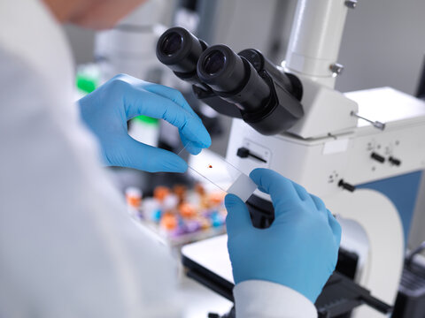 Scientist analyzing blood sample under microscope in laboratory