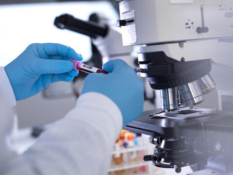 Scientist holding blood sample tube by microscope in laboratory