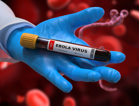 Ebola blood test tube with positive result. Background with Ebola and blood cells under a microscope.