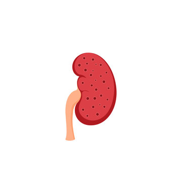 kidney infection Illustration 