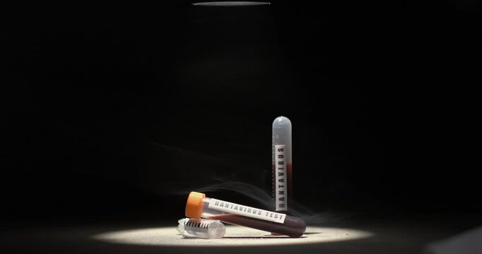 Super Slow Motion Phlebotomist Sample Under Clinical Spotlight, Super Slow
