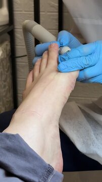 Close-up man foot pedicure diamond drill master wearing blue gloves working on toenail electric file smoothing callus salon lamp