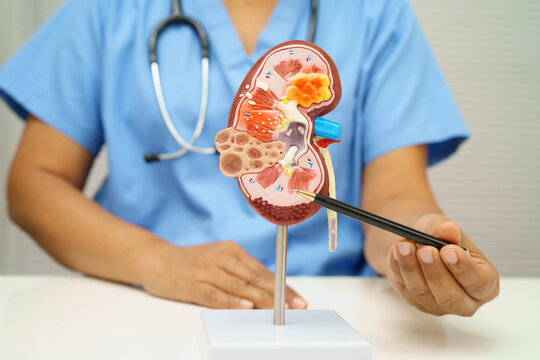 Chronic kidney disease, doctor with model for treatment urinary system, urology, Estimated glomerular filtration rate eGFR.