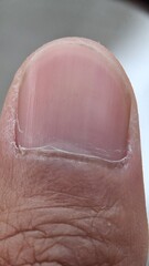 Fototapeta premium close up of human skin