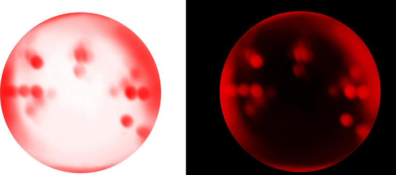 Microscopic red blood cells in petri dish, laboratory medical research on viral infection, biological cell culture under microscope