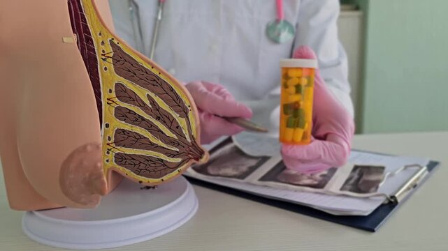 Doctor explains breast anatomy and medication use for patients in a clinic setting