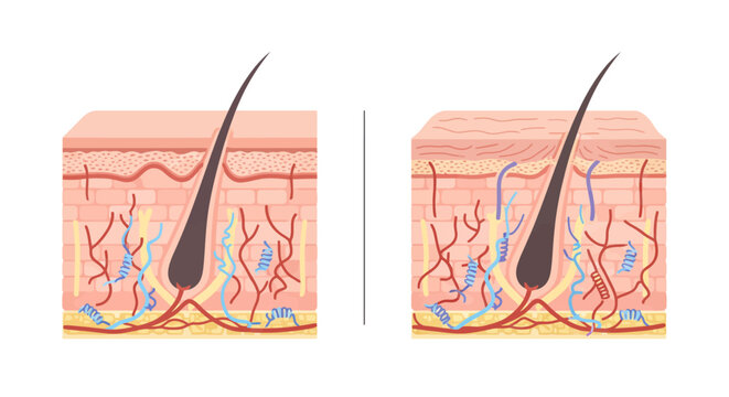 Comparison diagram of human skin layers and hair follicle anatomy