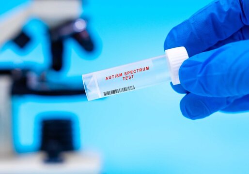 Identifies genetic markers linked to autism spectrum