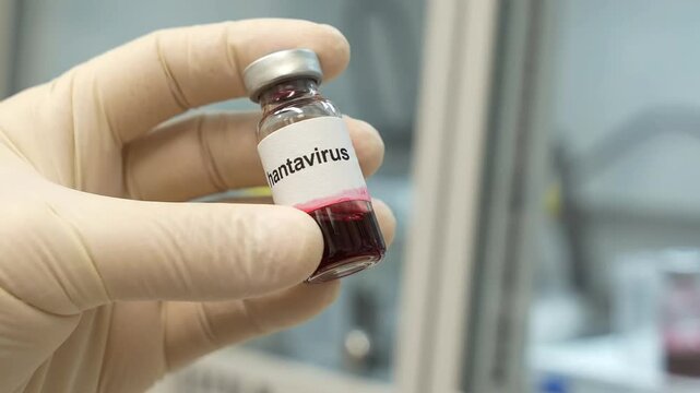 Scientist holding hantavirus sample vial in laboratory setting conducting research for virus testing and infectious disease prevention