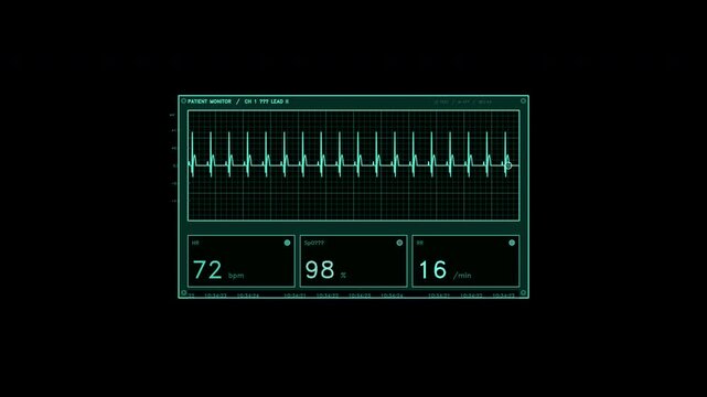 A cyan digital patient monitor interface featuring an ECG waveform, heart rate, SpO2, and respiratory rate readouts on a grid. Animated medical data panel loops for compositing.