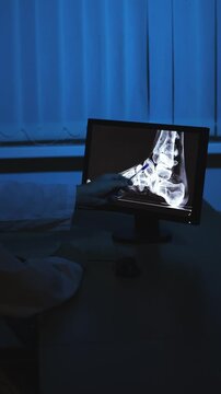 Leg. Foot. X-ray. Doctor in the office. Slow motion. . High quality 4k footage