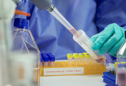 A scientist analyses a norovirus sample following a new case of norovirus infection in a laboratory