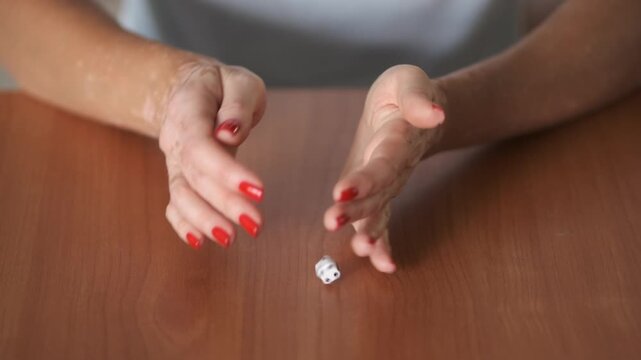 Close-up of female hands with vitiligo and red manicure placing dice on a wooden table. Concept of chance, risk, gambling, uncertainty, and inclusive beauty. Indoor lifestyle scene with focus on hands