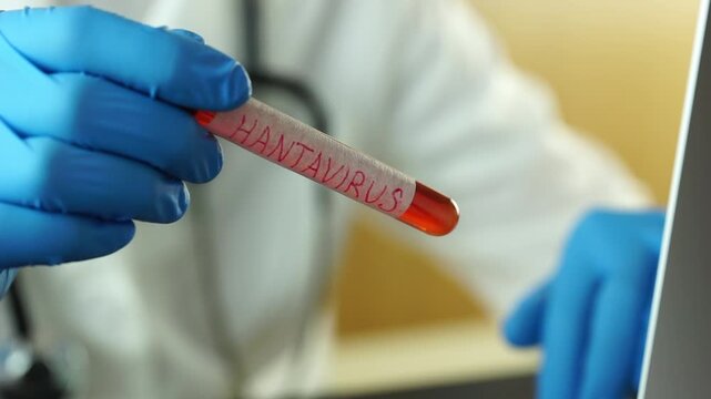 hantavirus test tube medical scientist hands holding blood sample research worker typing on laptop lab outbreak epidemic concept of medicine, healthcare, science