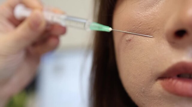 Cosmetologist prepares facial injection procedure for acne treatment and skin correction while young woman receives professional beauty care in aesthetic clinic