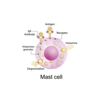 Mast cell. Activated mast cell. Immune system cells. Histamine. Anaphylactic, allergic reaction, Autoimmune disorders, allergy and anaphylaxis. IgE antibodies are involved in Anaphylactic reaction.