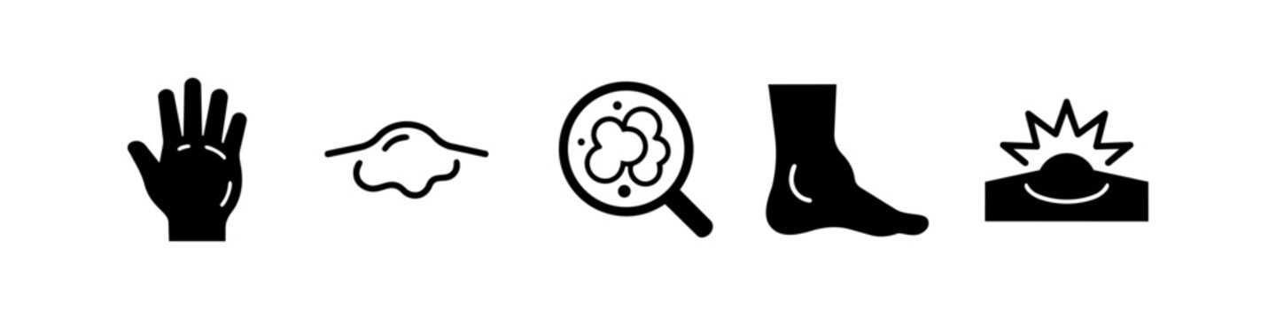 Vector set of black dermatology icons depicting various skin conditions, including warts, corns, and inflammation on hands and feet. Perfect for medical and healthcare education materials.