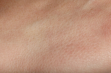 Fototapeta premium Texture of normal skin as background, closeup
