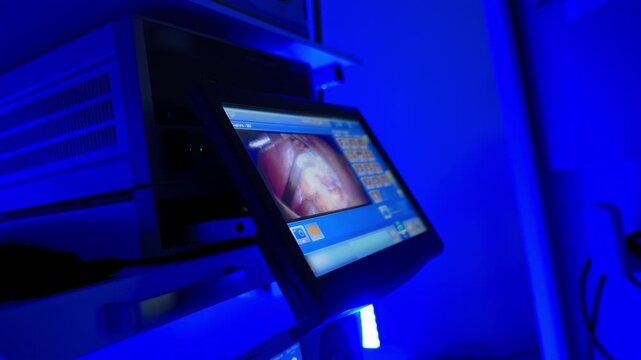Room with blue light and screen displaying the surgery. Operation with the usage of robotic equipment.