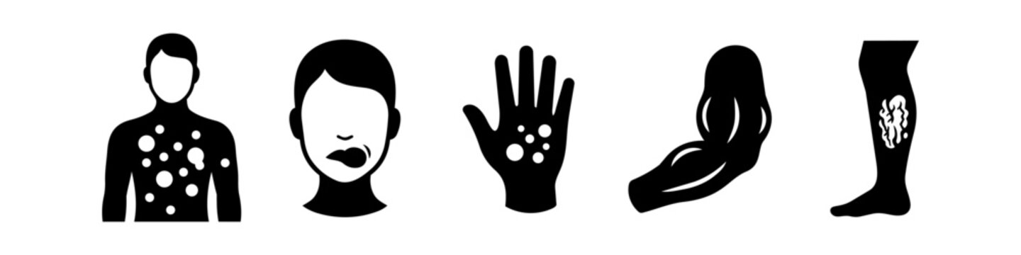 Set of medical and healthcare icons representing skin rash, allergic reaction, swollen lip, muscle growth, and varicose veins. Black and white vector silhouettes for clinical and wellness use.