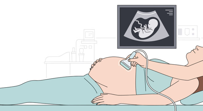 Pregnant woman undergoing ultrasound scan, showing baby on monitor screen