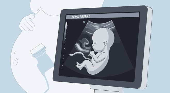 Pregnant woman's ultrasound showing baby's fetal profile on screen, medical technology concept