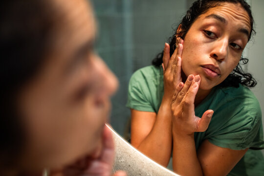 Woman examining acne on face in bathroom mirror