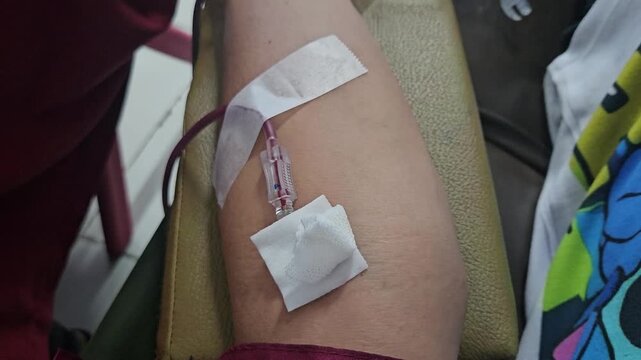 A close-up shot shows a needle catheter secured with medical tape and gauze on a donor's arm as dark red blood flows through a transparent tube during a blood donation or transfusion session.