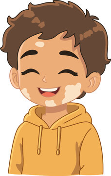 Vitiligo Boy Happy Smiling Portrait