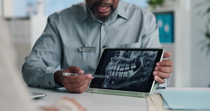 Hands, dentist and tablet screen with xray in office for mouth analysis, tooth structure and implant. Person, digital scan or patient consultation of wisdom teeth, cavity detection and dental results