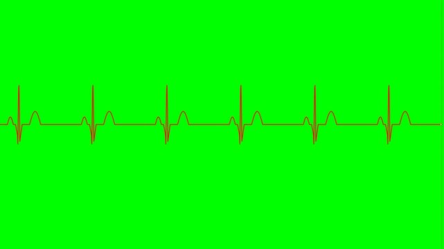 ECG waveform on a vibrant green background, depicting a regular heartbeat rhythm with distinct P, QRS, and T waves.