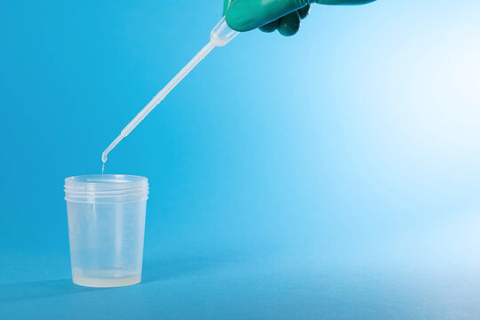 The doctor's hand collects ejaculate and prostate fluid for microscopic examination and leukocyte detection. Detection of infections by PCR. Copy space for text