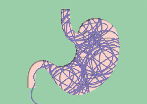 Knotted stomach, conceptual illustration