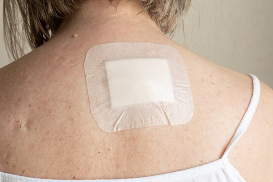 postoperative bandage after skin lesion removal on upper back