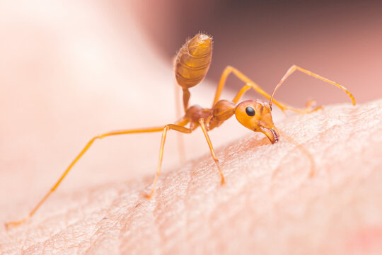 Red ant biting human skin close up