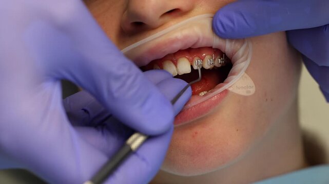 Orthodontist performing a dental examination on patient with braces