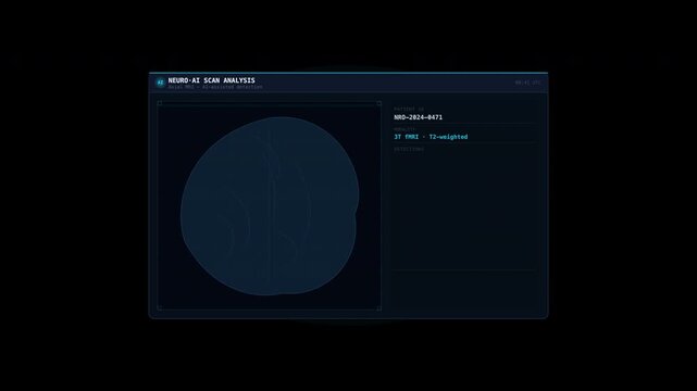 Medical brain scan from the video game prey, suitable for healthcare, technology, and gamingrelated projects needing futuristic imagery.