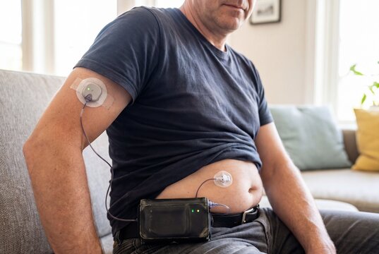 Man with Type 1 Diabetes Using Continuous Glucose Monitor and Insulin Pump at Home