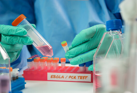 A scientist examines an Ebola virus PCR test in a laboratory