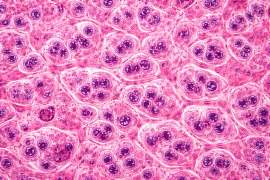 HE stained liver sample revealing full field of hepatocytes with multiple nuclei and nuclear enlargement signifying polyploidy