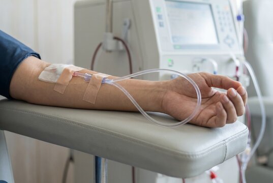 Patient Receiving Dialysis Treatment Through Intravenous Line