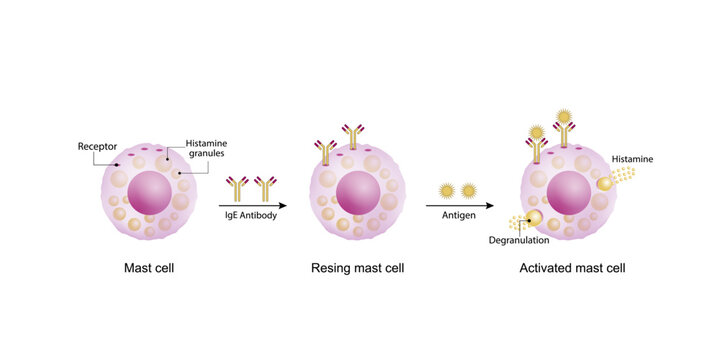 Resting and activated mast cell. Anaphylactic, allergic reaction, Autoimmune disorders, allergy and anaphylaxis. IgE antibodies are involved in Anaphylactic reaction. Vector illustration.