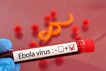 Obraz premium Hand holding ebola virus positive blood test
