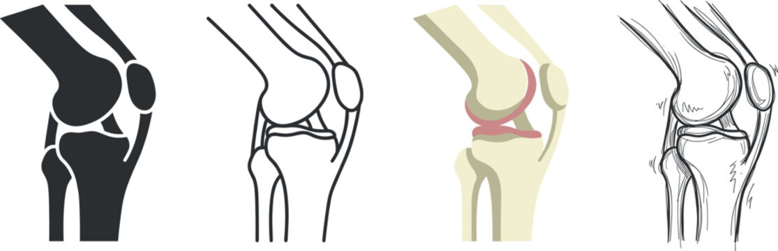 Medical diagram showing various artistic styles of the human knee joint anatomy displayed as a professional set on transparent background